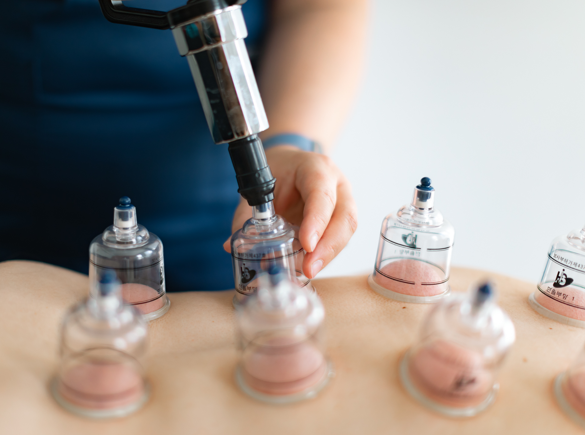 A person using vacuum cups for cupping therapy on a back in Leesburg.|Boost Your Commercial & Branding Photographs
